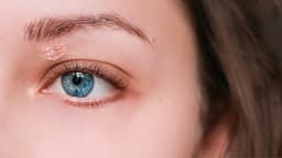 Eyelid Psoriasis