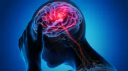 How a Stroke Can Change Your Vision
