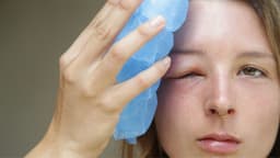 Swollen Eyelids: What Is Causing My Swollen Eyelids?
